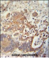CHCHD2 Antibody (Center)